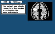 Life & Death II: The Brain